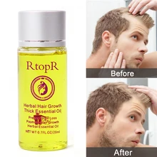 Для женщин и мужчин, травяная эссенция для роста волос, против выпадения волос, жидкая, способствует густому быстрому росту волос, лечение мужчин, эфирное масло, забота о здоровье