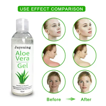 

Aloe Soothing Gel Aloe Vera Gel Face Skin Care Remove Acne Moisturizing Day Cream After Sun Lotions Anti Wrinkle Aloe Gel