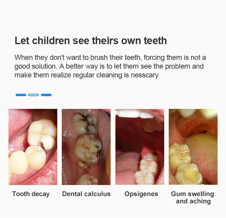 Oral Dental Intraoral Camera HD 720P WIFI Endoscope Teeth Mirror Wireless Oral Real-time inspect camera otoscopio tooth camera