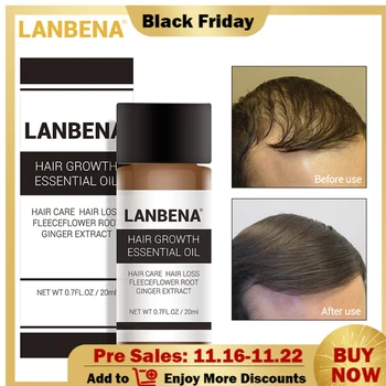 

10pcs LANBENA Hair Growth Essence Fast Powerful Care Essential Oil Liquid Treatment Preventing Hairs Loss Products for Men