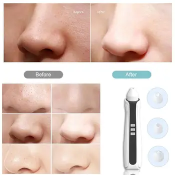 

USB Rechargeable Visual Blackhead Remover Pores Black Head Cleaner 500X Vacuum Camera Microscope WIFI G9L5