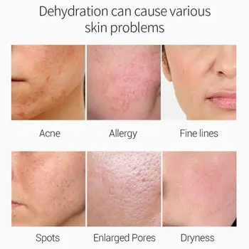 

100ml Mashed Potato Mask Shrink Pores Oil Control Solid Mask Mud Skin Deep Mashed Mask Cleansing Secrum Care Potato D8W3