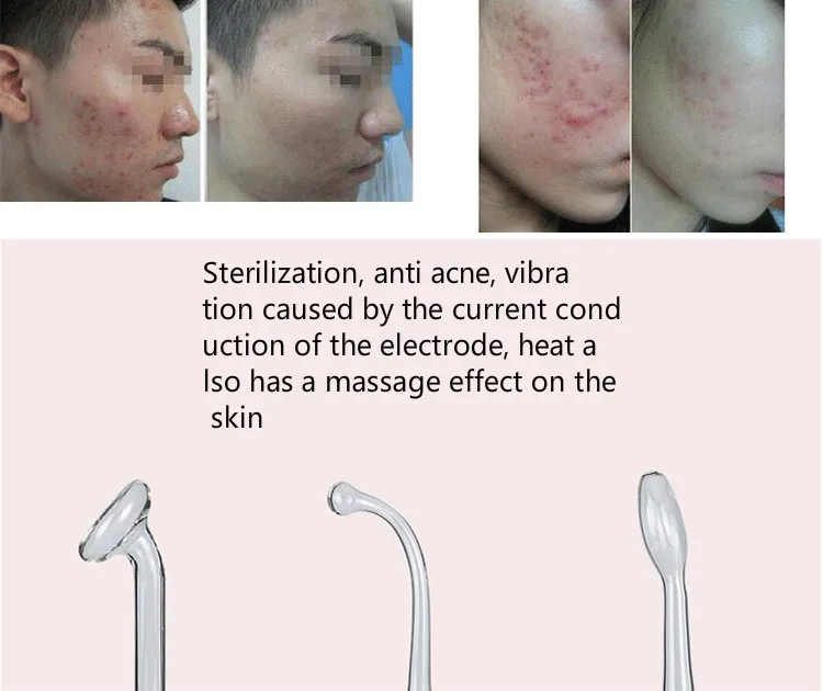 High frequency beauty instrument pigmentation removal anti-acne disinfection machine spa salon homeuse skin care tools