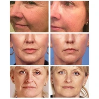 AuQuest 5 sekund preparat przeciwzmarszczkowy natychmiastowy mocno Anti-Aging nawilżający usuń Fineline krem do twarzy uroda pielęgnacja skóry 20G 3