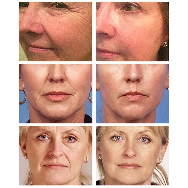 AuQuest 5 Seconds Wrinkle Remover Instant Firmly Anti Aging Moisturizing Remove Fineline Face Cream Beauty Skin Care 20G-2