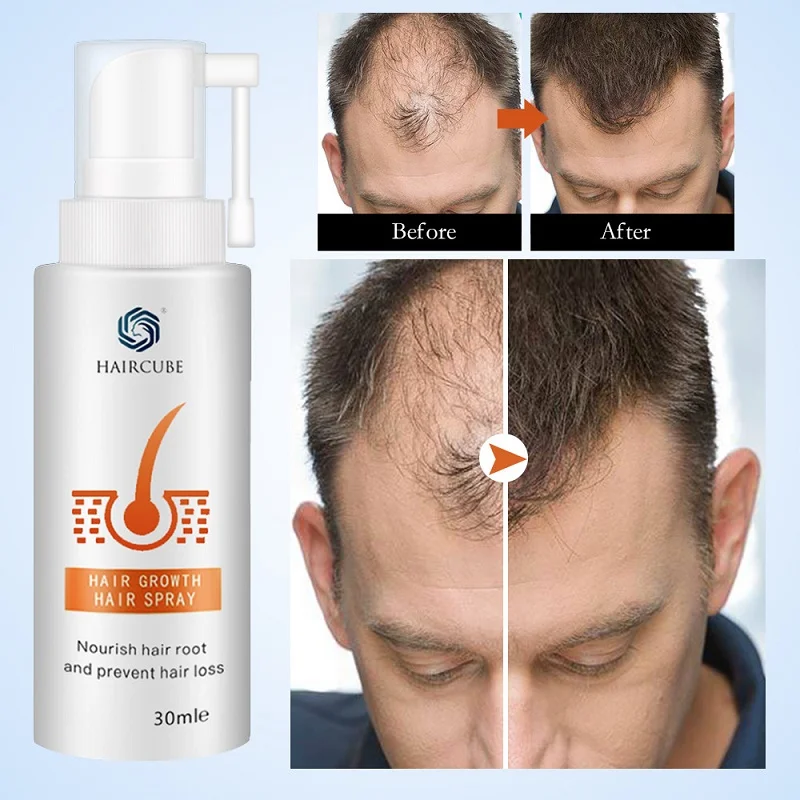 Best Buy Hair-Growth-Products Spray Haircube-Stop Anti-Hair-Loss Essential-Oil Fast for Men Woman OnwZeMMwEol