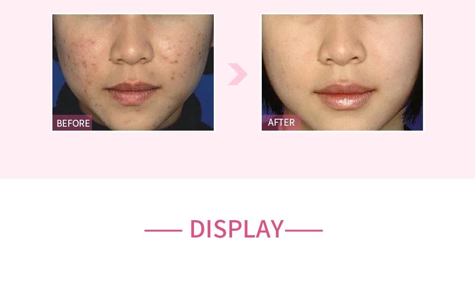 素颜补急保湿洁肤泥2_07