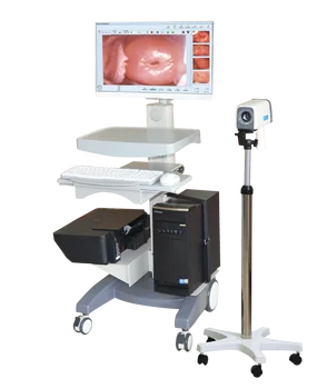 

HD type portable digital colposcope