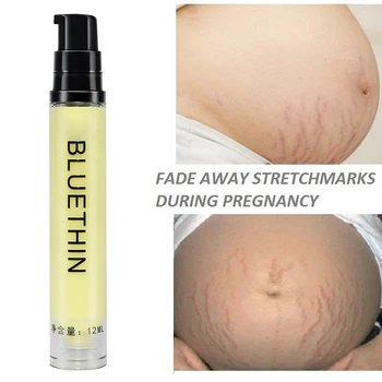 

Remove Pregnancy Scar Acne Cream Eliminate Pregnancy Scars Maternity Repair Anti Winkle Skin Firming Body Creams Skin Care TSLM1