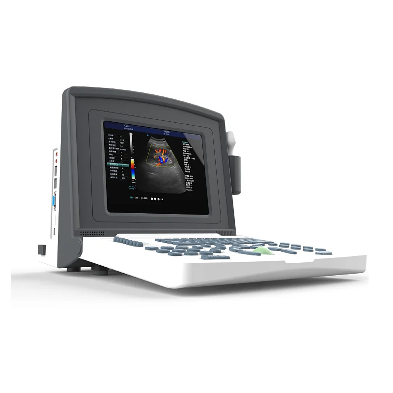 Image for 12 Inch Led Human Color Doppler Laptop Ultrasound  