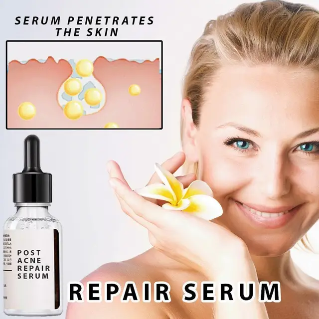 30ml Salicylic Acid 2 Solution Removes Acne Face serum Shrinks Pore Moisturizing Essence Fade Spot Brighten