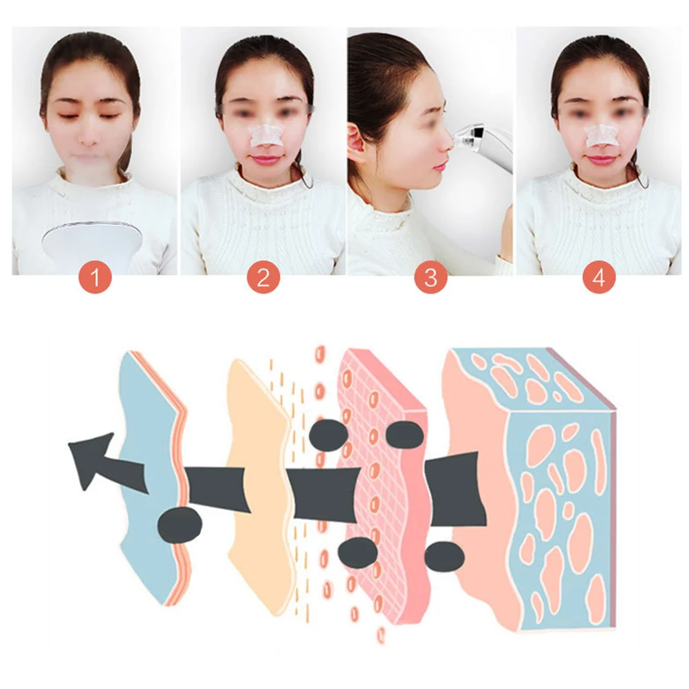 Sucker Clove Black Dots Spatula for Acne Device Squeezing Out Pimples Cleaning The Face Nose From 4