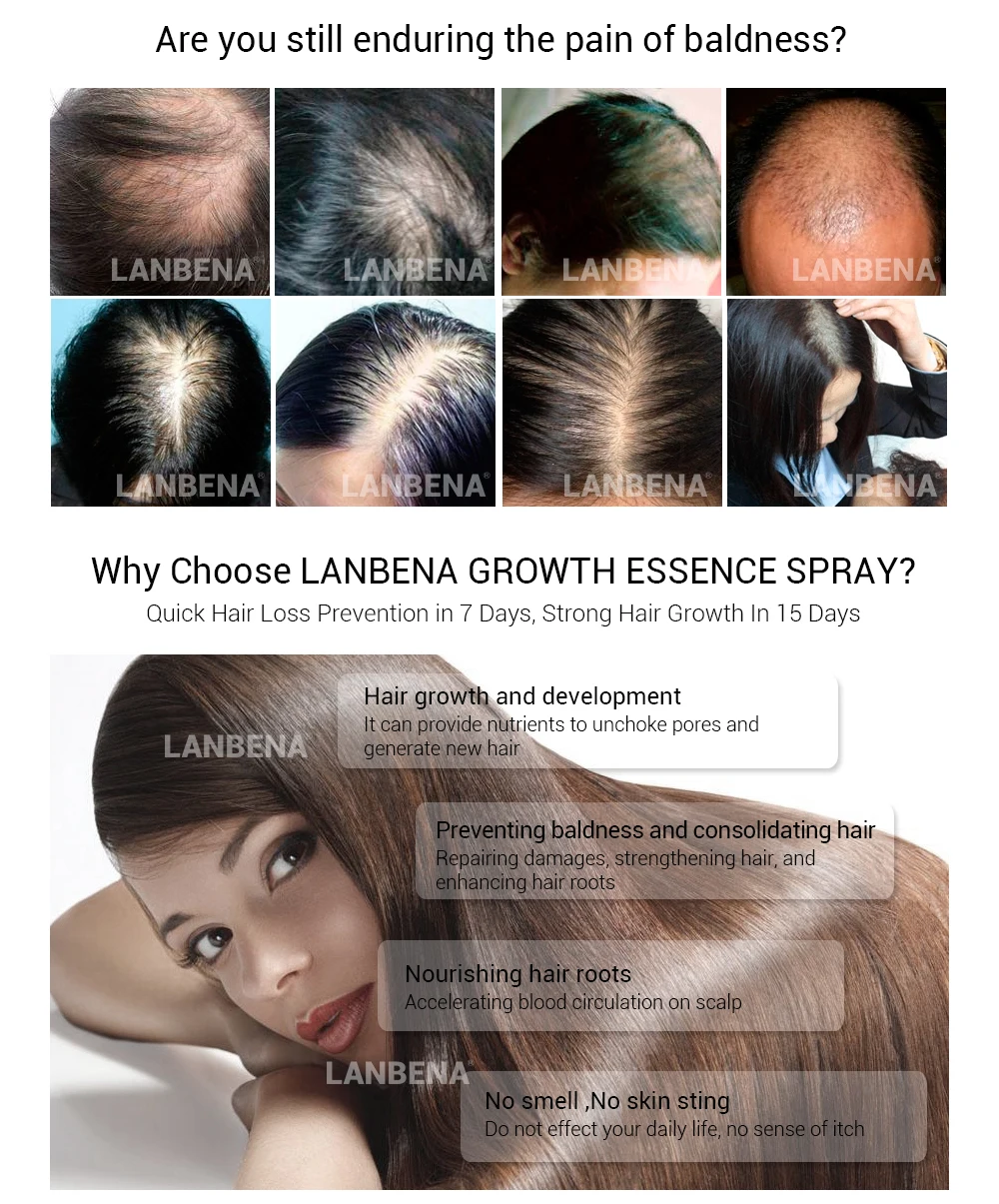LANBENA эссенция для роста волос спрей продукт для предотвращения облысения укрепляющий против выпадения волос питает корни легко переносить Уход за волосами