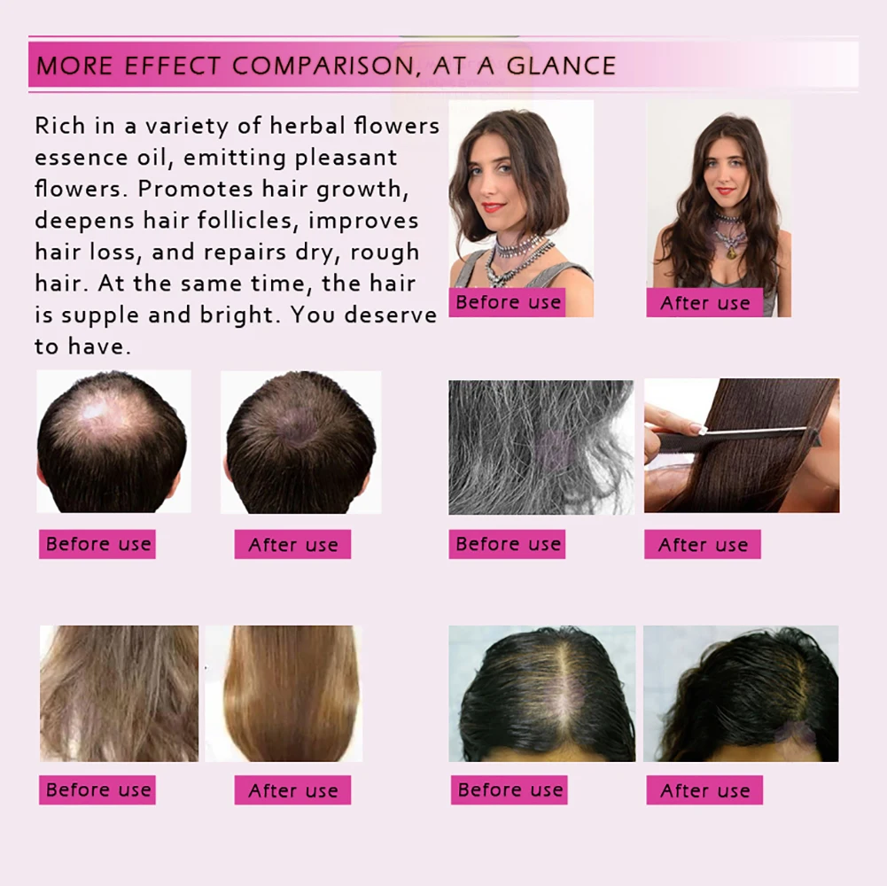 20ml Effective Repair Scalp Care Growth Nourish Smoothen Itch Reduce Hair Essential Oil Treatment Organic Natural Extract Herbal