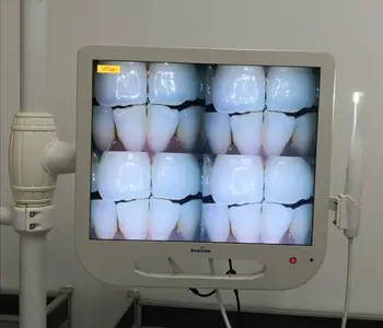 

17 Inch Metal Case Monitor Intraoral Camera 16GB Memory With plastic holder