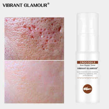 

Crocodile Face Serum Spray Toner Removal Scars Shrink Pores Repair Acne Scar Marks Relieve Sensitive Face Care