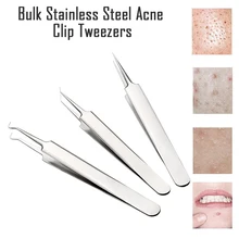 Special Offers 1PC Stainless Steel  Blemish Extractor Tool For Remove Comedones Blackhead Acne Pimple Tools 2020