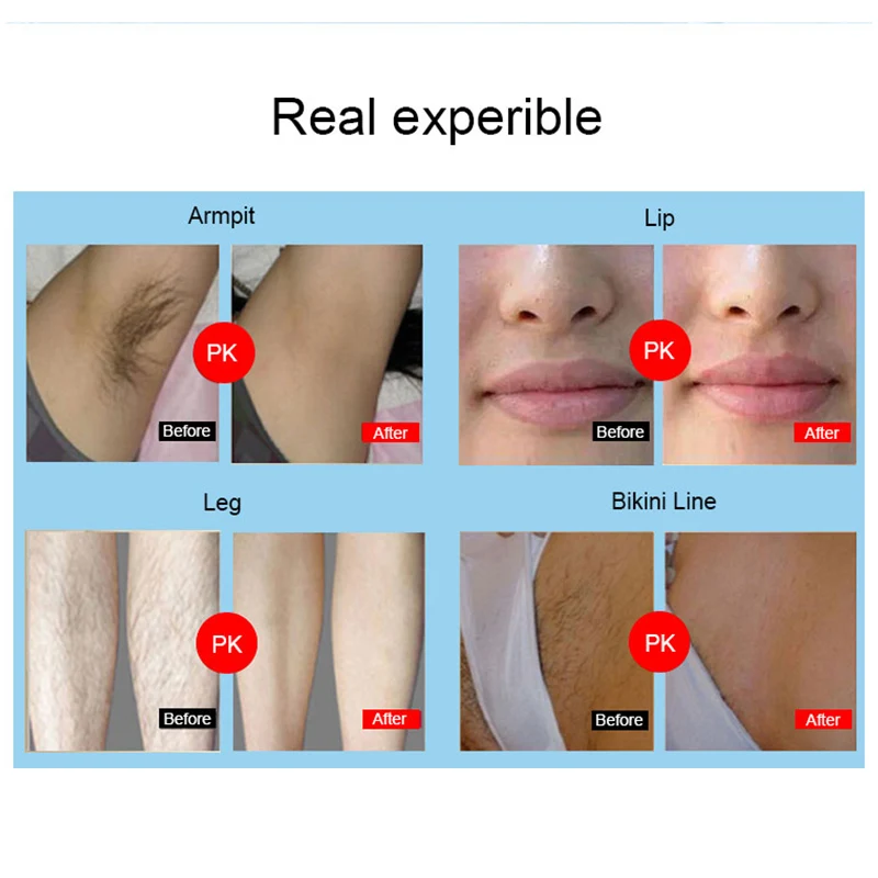 Женский эпилятор инструмент для удаления волос 990000 Flash Professional body facial legs бикини lips