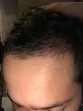 Cuidado del cabello para el crecimiento del cabello aceites esenciales esencia Original auténtico 100% pérdida de cabello líquido salud belleza suero denso para el crecimiento del cabello
