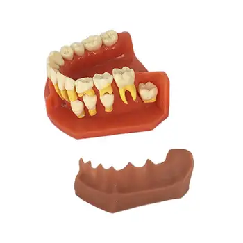 

Dental Children Removable Deciduous Teeth Model Permanent Tooth Alternative Display Studying Teaching Tool