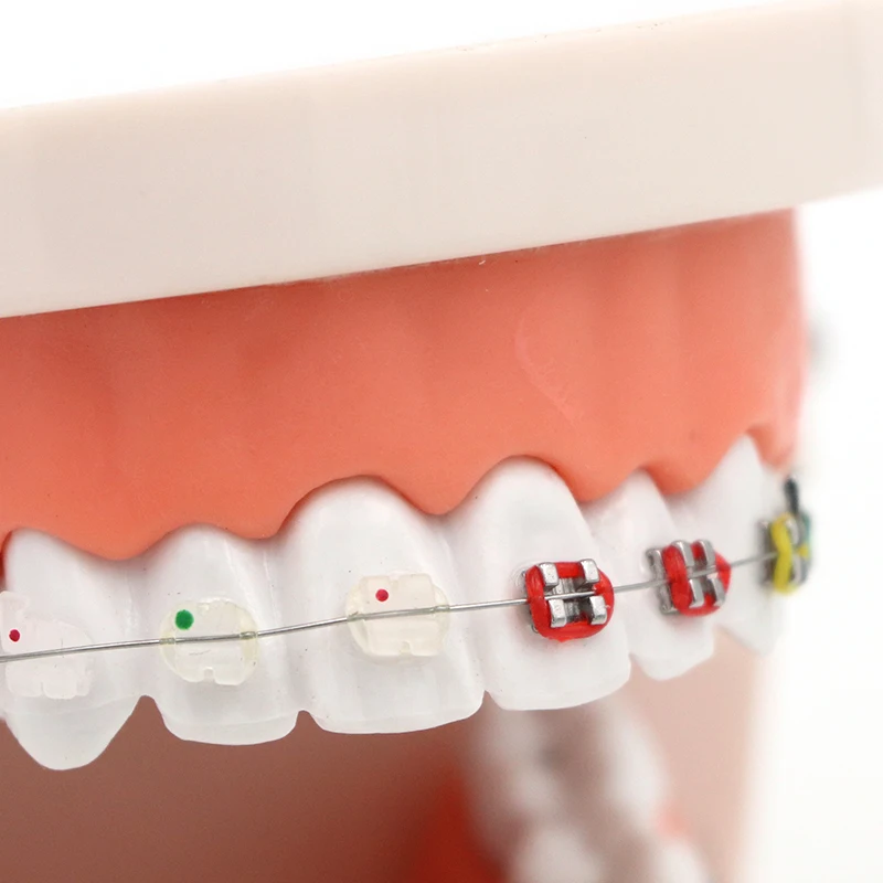 1 шт. Стоматологическая Ортодонтическая модель лечения с Орто-металлическим керамическим кронштейном Arch Wire Buccal Tube Ligature Ties стоматологические инструменты