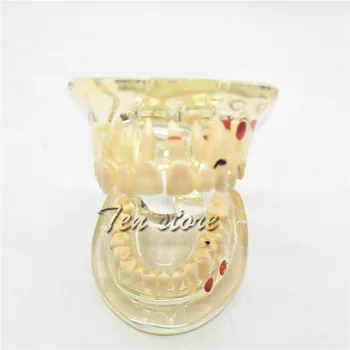 

Dental Study Model Tooth Transparent Teeth Adult Pathological Dental Lab Equipment Dentist Dental Lab Teaching