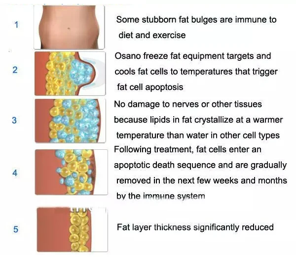 Портативный Velashape десятый V10 вакуумная кавитационная машина для похудения для коррекции фигуры, подтяжки лица и подтяжки глаз