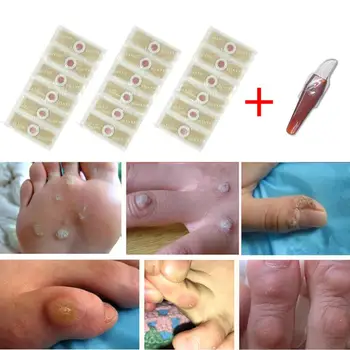 

18pcs/lot Foot Core Caps Relieve Pressure Paste Dead Skin Remove Hard Cocoons Calluses Foot Corn Removal Plaster Feet Care Kit