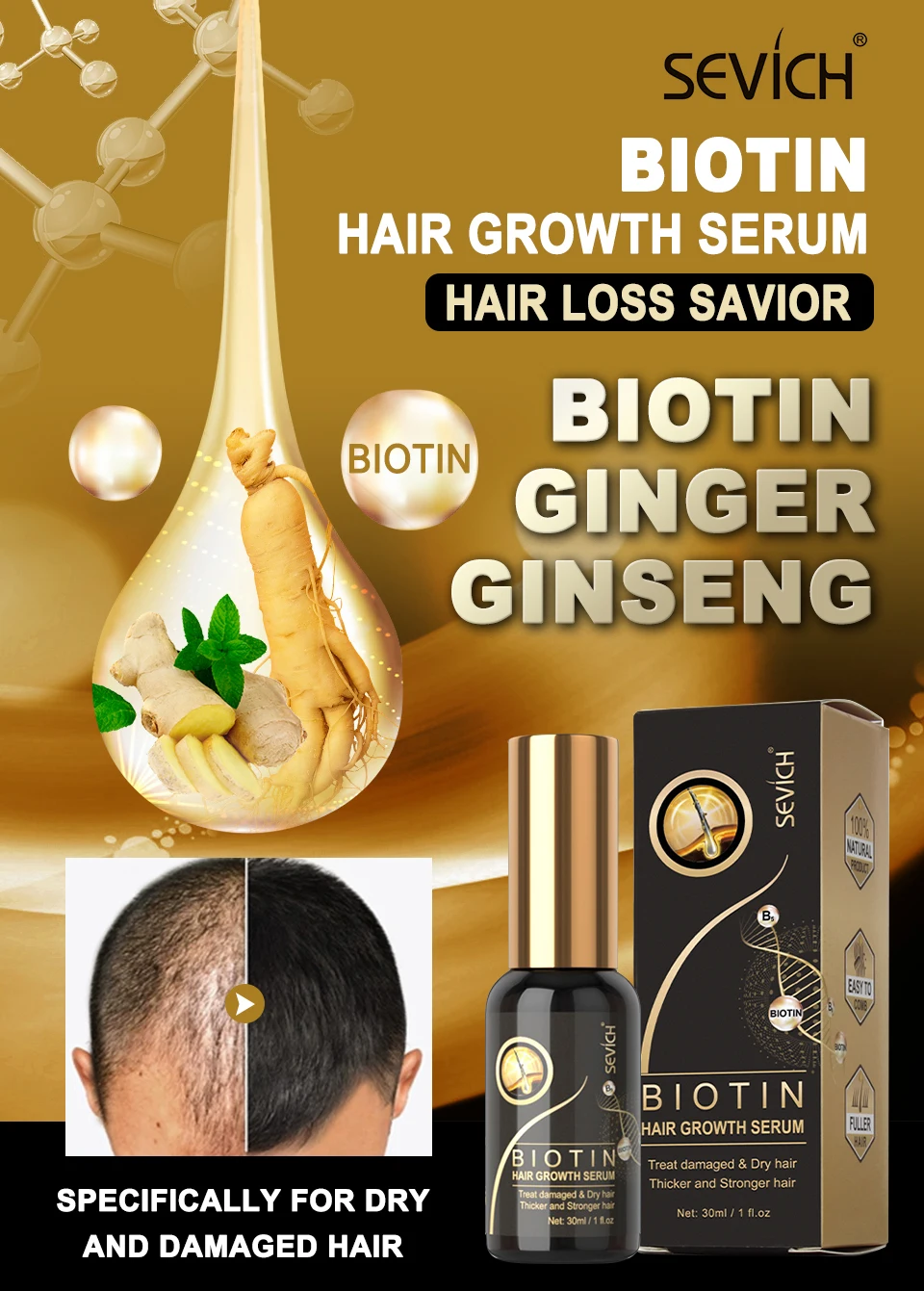 Sevich 30ミリリットルビオチン育毛スプレーハーブヘアケア血清高速抗脱毛治療不可欠育毛オイル 脱毛製品 Aliexpress