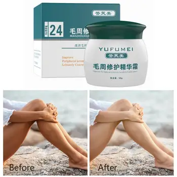 

50g Natural Formula Face Foliculitis Whole Body Skin Cream Repair Chicken Care Pilaris/ Lotion For Curing Keratosis Skin Sk