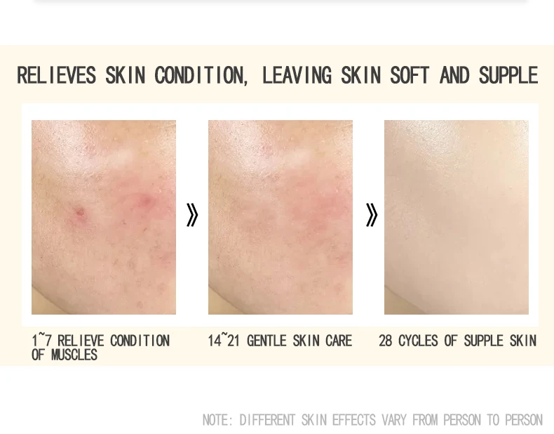 PinkyPinky Anti-mite handmade soap cleansing face deep cleaning sea salt essential oil ginseng soap foaming net