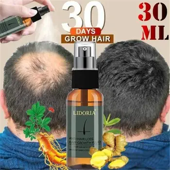 

Blue ZOO 30ML Hair Growth Spray Essential Oil Hair Loss Liquid Care Beauty Hair Growth Spray for Men Women Hair Care Treatment