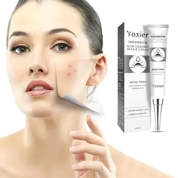 

New 20g Acne Treatment Blackhead Anti Acne Cream Oil Control Shrink Pores Acne Scar Remove Face Care Whitening Dropping TSLM1