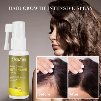 

30ml Hair Growth Intensive Spray Ginseng Ginger Extract Stimulate Hair Growth Dense Thickening Hair Anti Hair Loss Essence