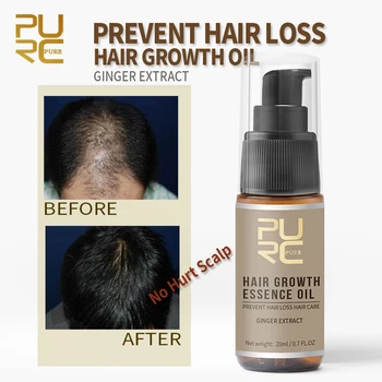 

PURC Ginger Extract Fast Hair Growth Essence Essential Oil Liquid Treatment Anti Preventing Hair Loss Hair Care Products 20ml