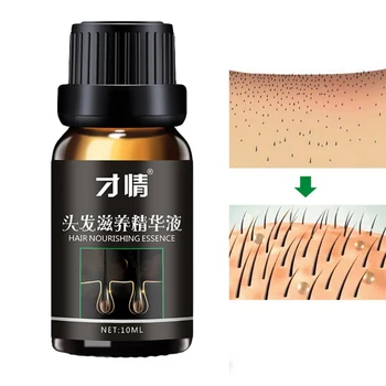 

High Quality Hair Growth Serum Oil Extract 10ml/bottle Hair Growth Essence Most Effective