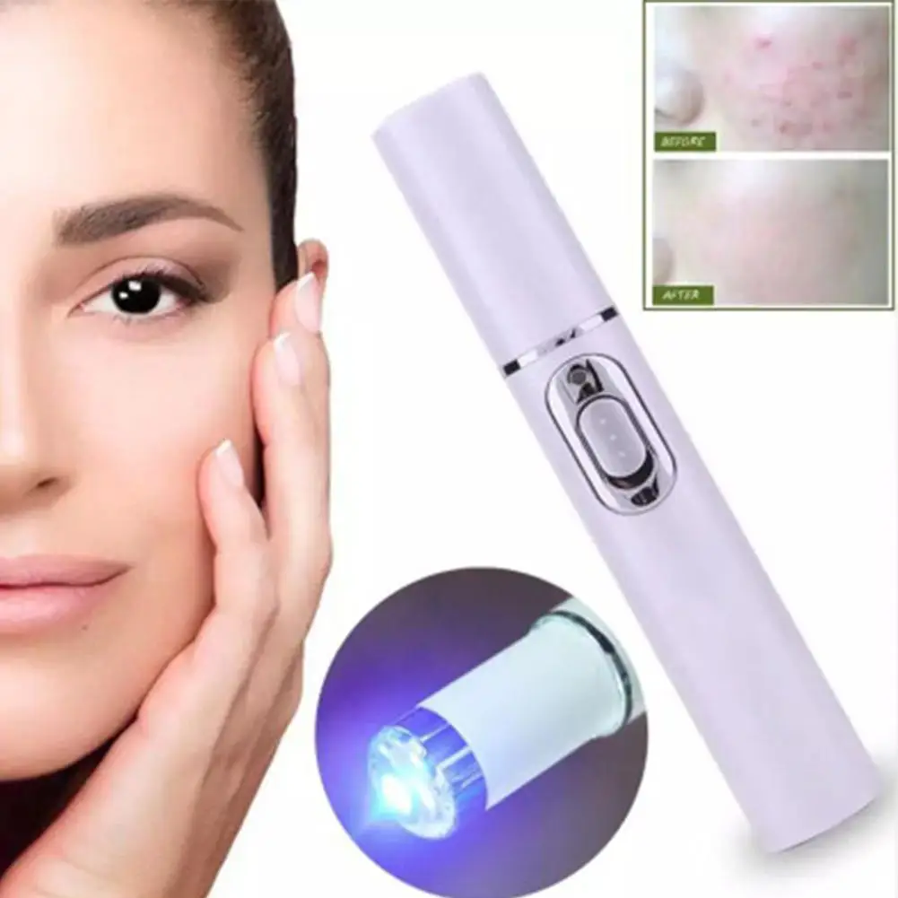 HobbyLane Blu-ray Acne Removing Blue Light Pen Scar Removal Anti Wrinkle Aging Therapy Beauty Device Face Machine Hot | Красота и
