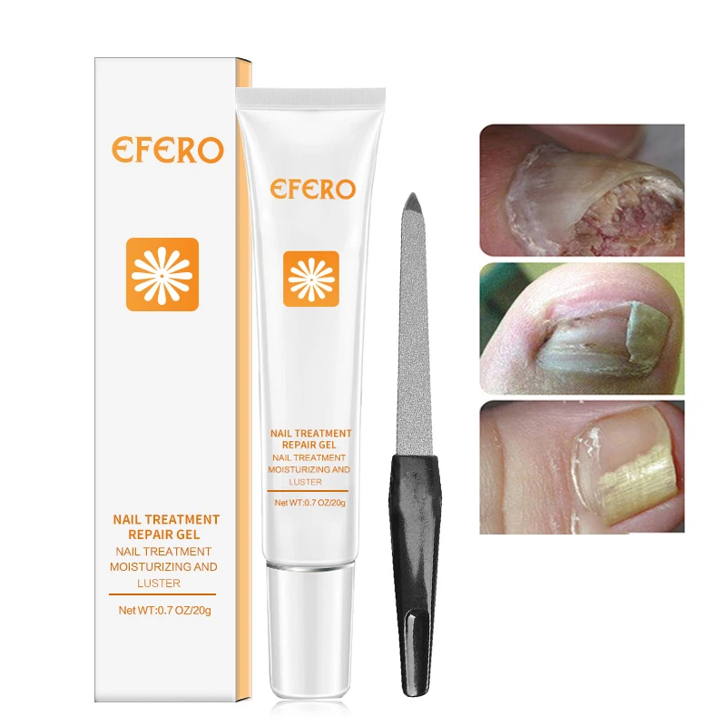 Luxury Offer for  efero Nail Repair Essence Foot Fungal Nail Treatment Remove Onychomycosis Whitening Feet Hand Toe N