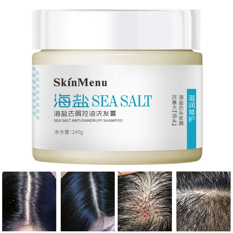 Sea Salt Anti-Dandruff Shampoo Cream Relieve Itching Control Oil Hair Shampoos Hair Care @ME88 Sea Salt Anti-Dandruff Shampoo Cream Relieve Itching Control Oil Hair Shampoos Hair Care @ME88