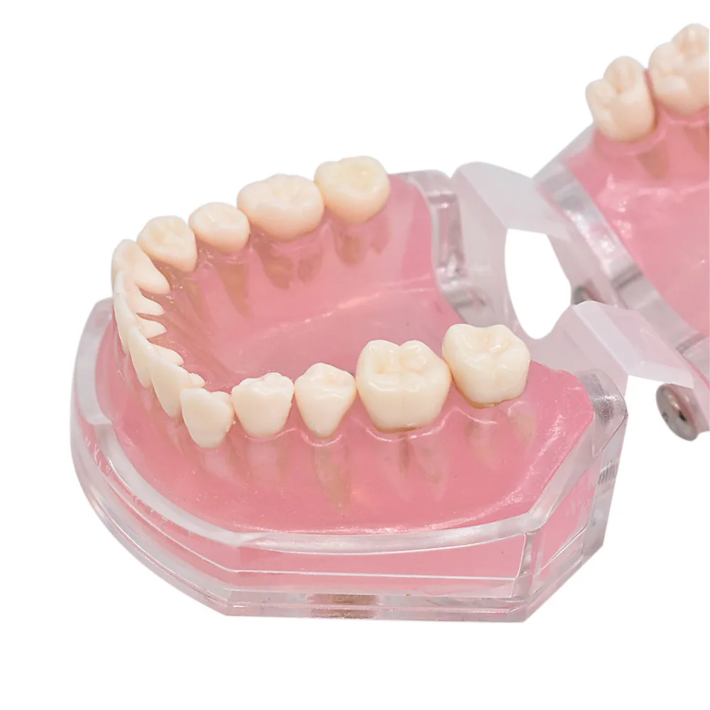 Стоматологический стоматолог мягкая основа позволяет выщипывать высасывать вытягивать съемные зубы мягкая резинка Учебная модель для взрослых TYPODONT