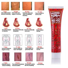 Новое горячее модное лечение Варикозного расширения вен крем вариксия ангиит крем удаление травяной крем красота Товары для дома