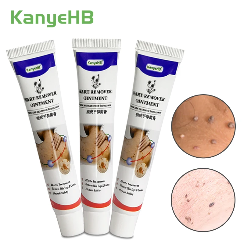 

3pcs Warts Remover Antibacterial Ointment Wart Treatment Herbal Extract Corn Calluses Removal Plaster Skin Care Warts Ointment