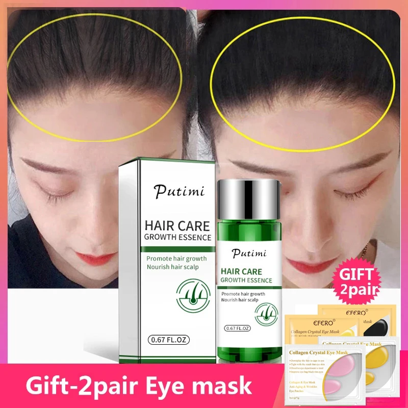 Essence-Treatment Care Hair-Loss-Products Hair-Growth-Essence Fast Preventing Putimi