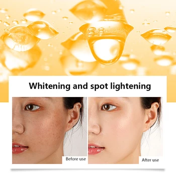 

15ml Instant Blemish Removal Gel VC Whitening Freckle Serum Strong Effect Whitening Cream Brighten Skin Face Care Cream TSLM1