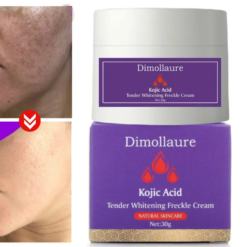 *dimollaure Kojic Acid Whitening Cream Moisturizing Removal Age Spots