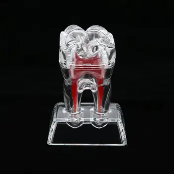 

Teeth Whitening Dentist Dental Teeth Model Separable Plastic Teeth Endodontic Student Educational Tool Dentistry Tooth