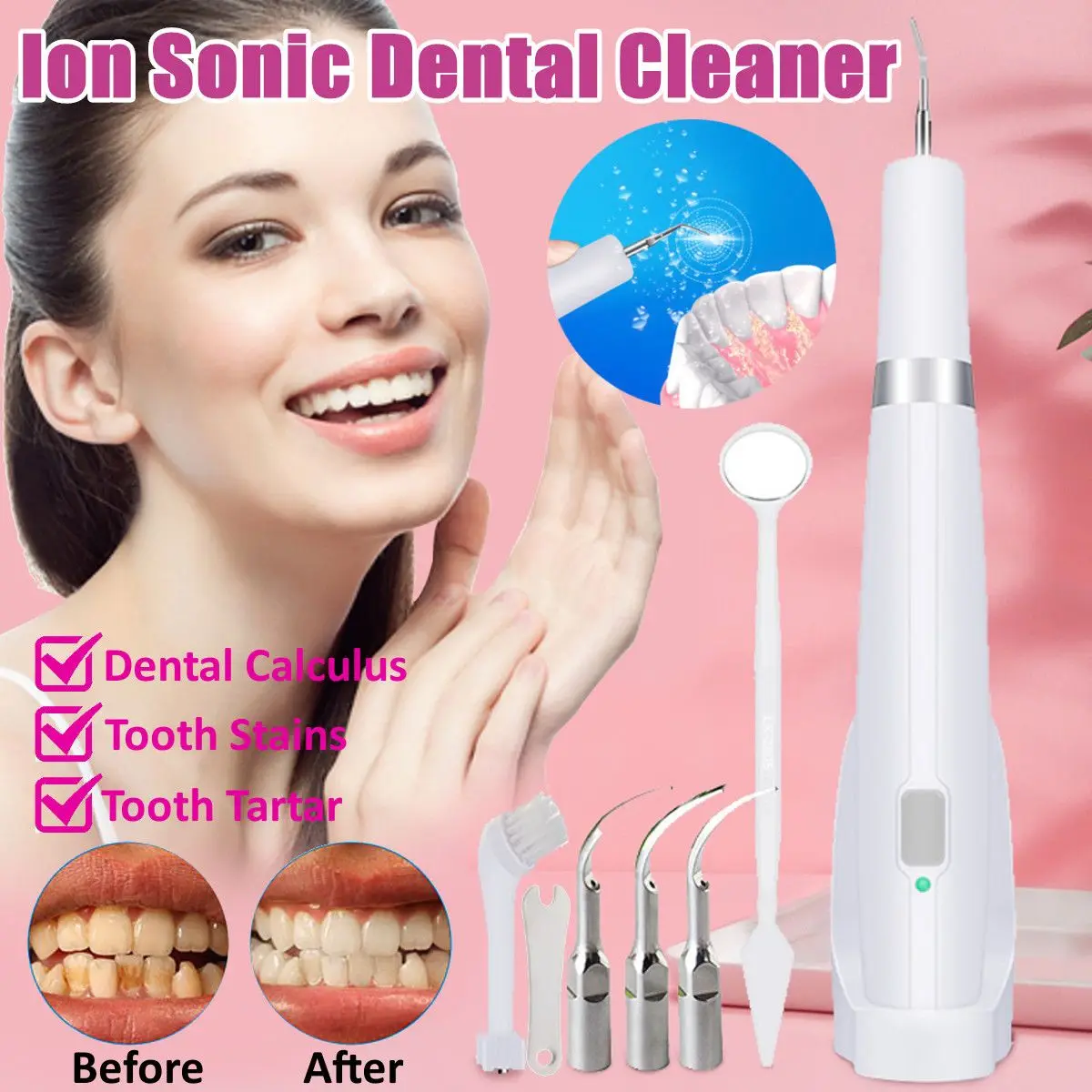 

Electric Dental Calculus Plaque Smoke Stains Remover High Frequency Vibration Tartar Removal Cleaning Tool Teeth Whitening