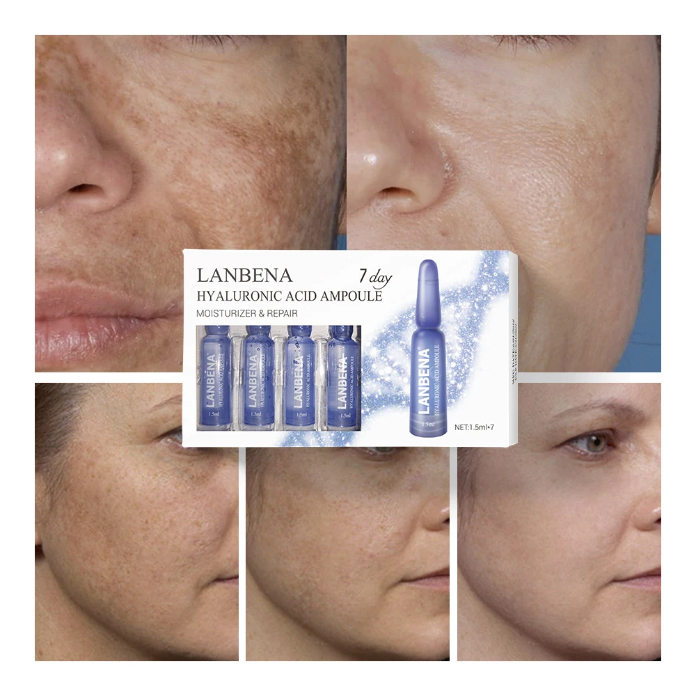 LANBENA 7 Days Ampoule Serum Hyaluronic Acid+Vitamin C+24K Gold Retinol+Q10+Ceramide Anti-Aging Wrinkle Moisturizing Skin Care LANBENA 7 Days Ampoule Serum Hyaluronic Acid+Vitamin C+24K Gold Retinol+Q10+Ceramide Anti-Aging Wrinkle Moisturizing Skin Care