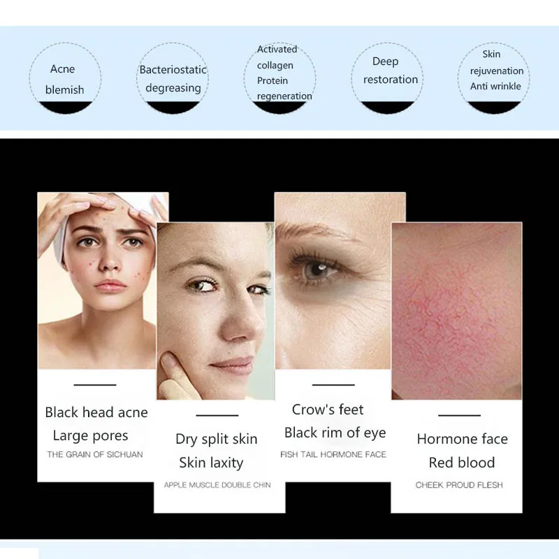 Professional Photon PDT Led Light Facial Mask Machine 6 Colors Acne Treatment Face Whitening Skin Rejuvenation Light Therapy