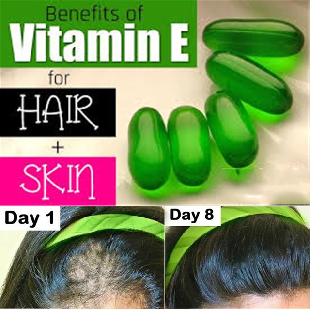 Share more than 158 vitamin e for hair growth super hot ceg.edu.vn